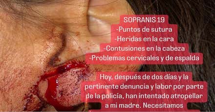 El número 19 de la calle Sopranis de Cádiz: okupas, amenazas, drogas, agresiones e intentos de atropello