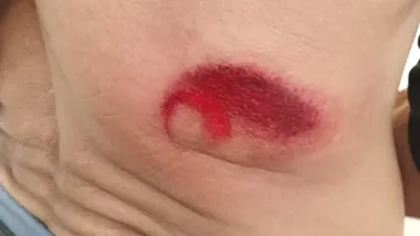 Denuncian una actuación "irresponsable" y "peligrosa" de la Policía en la huelga del metal de Cádiz