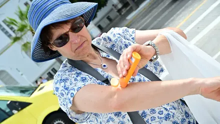 Una mujer se pone crema de protección solar