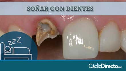 Dientes Rotos