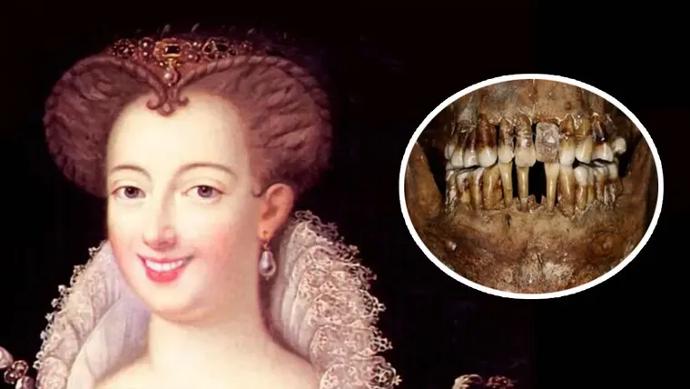 Cuadro y dentadura de Anne d’Alègre.