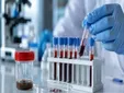 Asescon denuncia un error en el cribado de cáncer en Andalucía: 400 personas recibieron resultados incorrectos
