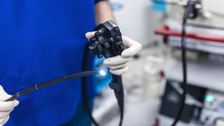 Médico con una sonda para hacer una colonoscopia.